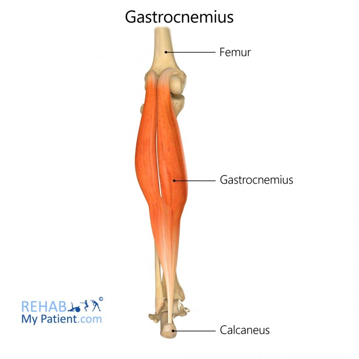 Which muscle is indicated by the arrow